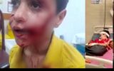 جان باختن کودک ۱۰ ساله بر اثر حمله سگهای ولگرد جان باختن کودک ۱۰ ساله بر اثر حمله سگهای ولگرد